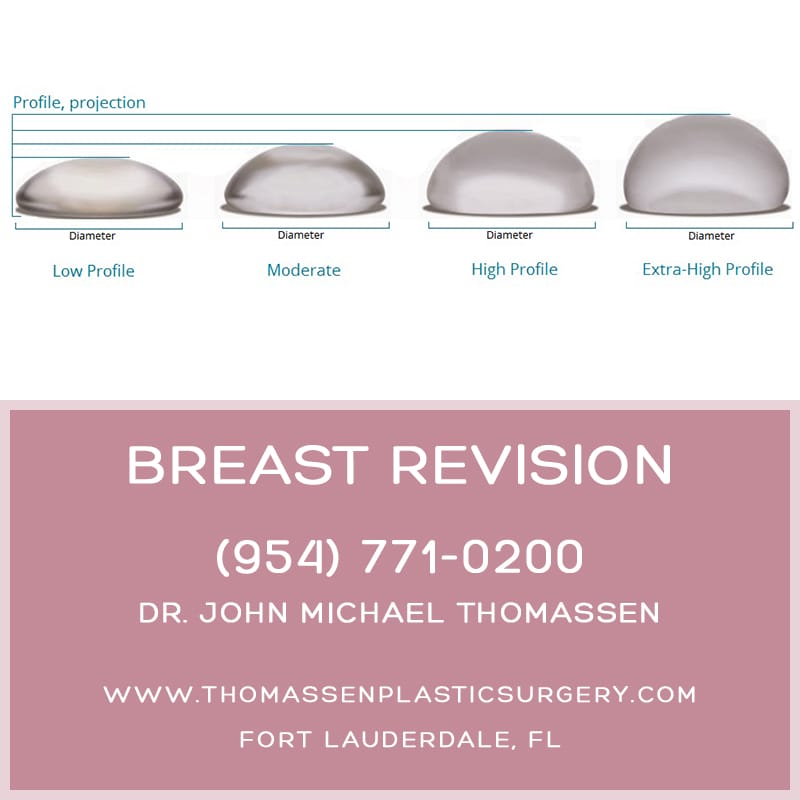 Breast Augmentation Revision Fort Lauderdale